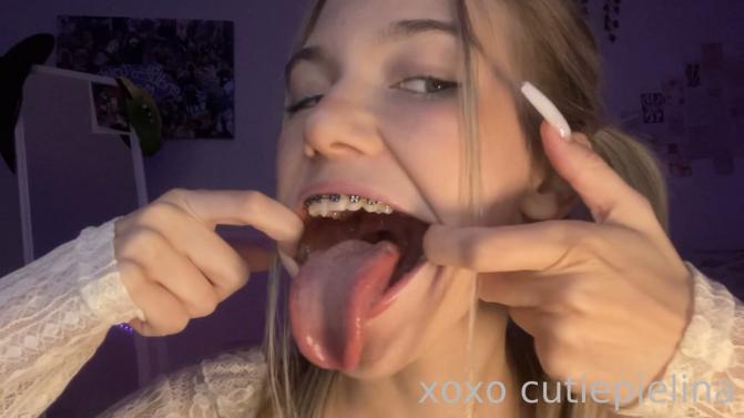 CrazyCuteLina - Braces Babe