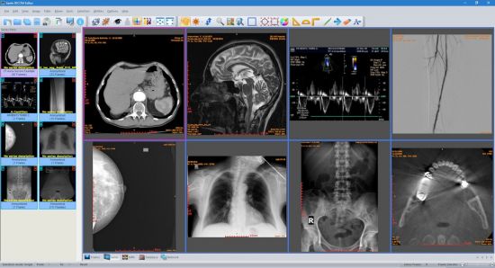 Sante DICOM Editor 10.2.3