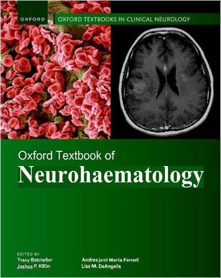 Batchelor T , Weller M Oxford Textbook of Neuro-Oncology 2ed 2025