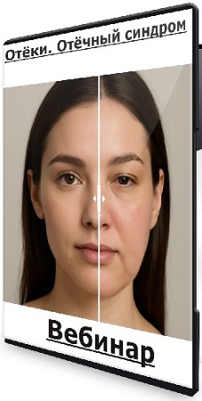 постер к [hlsa] Павел Баранов - Отёки. Отёчный синдром (2025) Вебинар