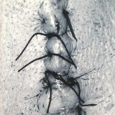 Scheer - Infliction (1996)